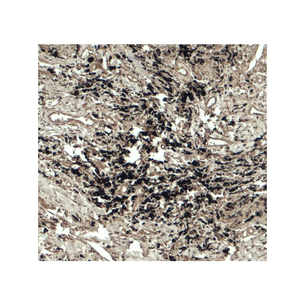 ProSci 7989 Beclin 2 Antibody, ProSci, 0.1 mg/Unit Secondary Image